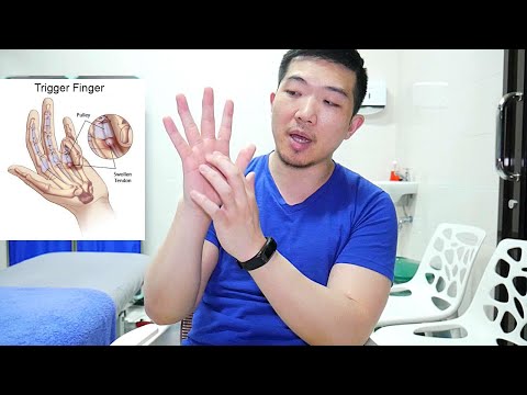 Video Trigger finger & jari kaku 🖐🏻: Sembuhin sendiri dengan cara mudah! 2021