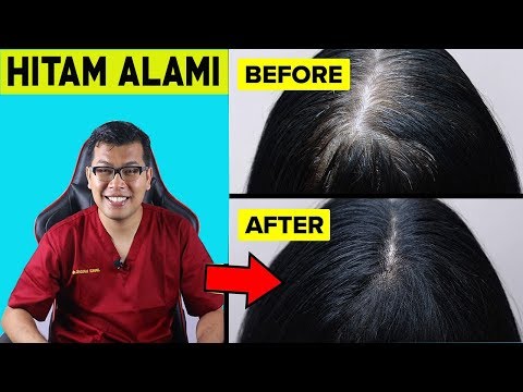 Video Cara Mengatasi Ubanan Rambut Putih Secara Alami – dr Saddam Ismail 2021