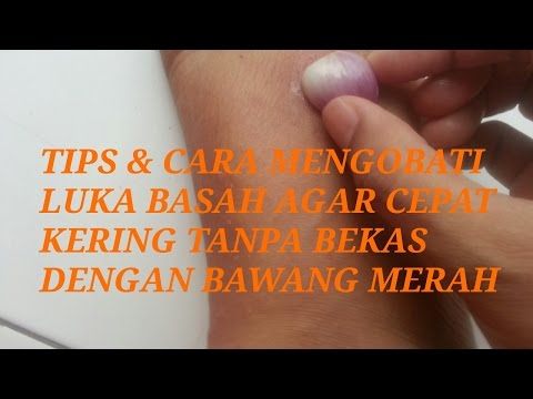 Video CARA Ampuh mengobati luka basah agar cepat kering tanpa bekas 2021