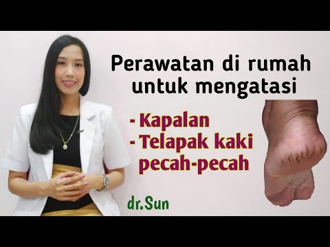 Video Cara Mengatasi Telapak Kaki Pecah-pecah 2021