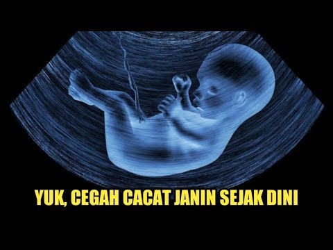 Cara Mencegah Cacat Janin Yang Perlu Ibu Hamil Lakukan 2021